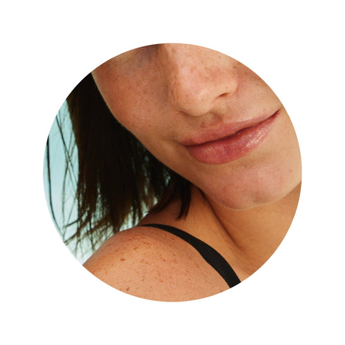 SPOTS & BLEMISHES